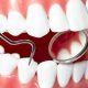 Oral Health